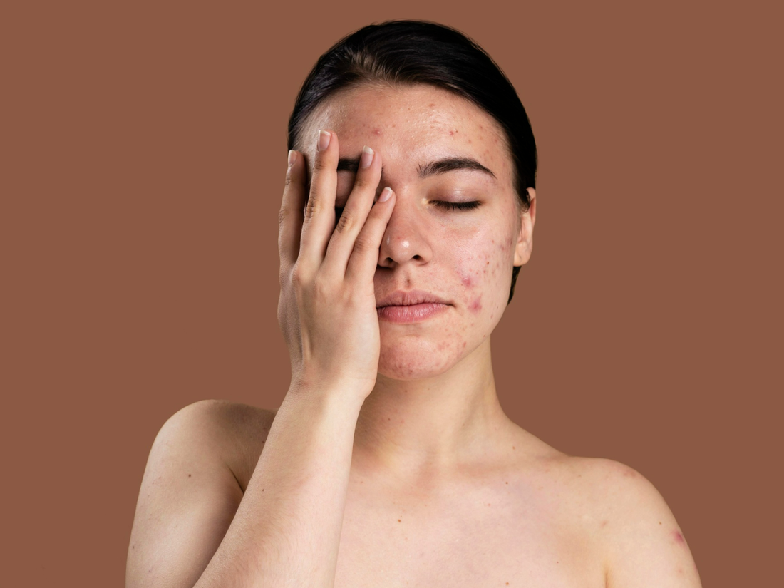 Pigmentation and Skin brightening title image